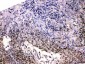 Anti-HDGF Picoband Antibody